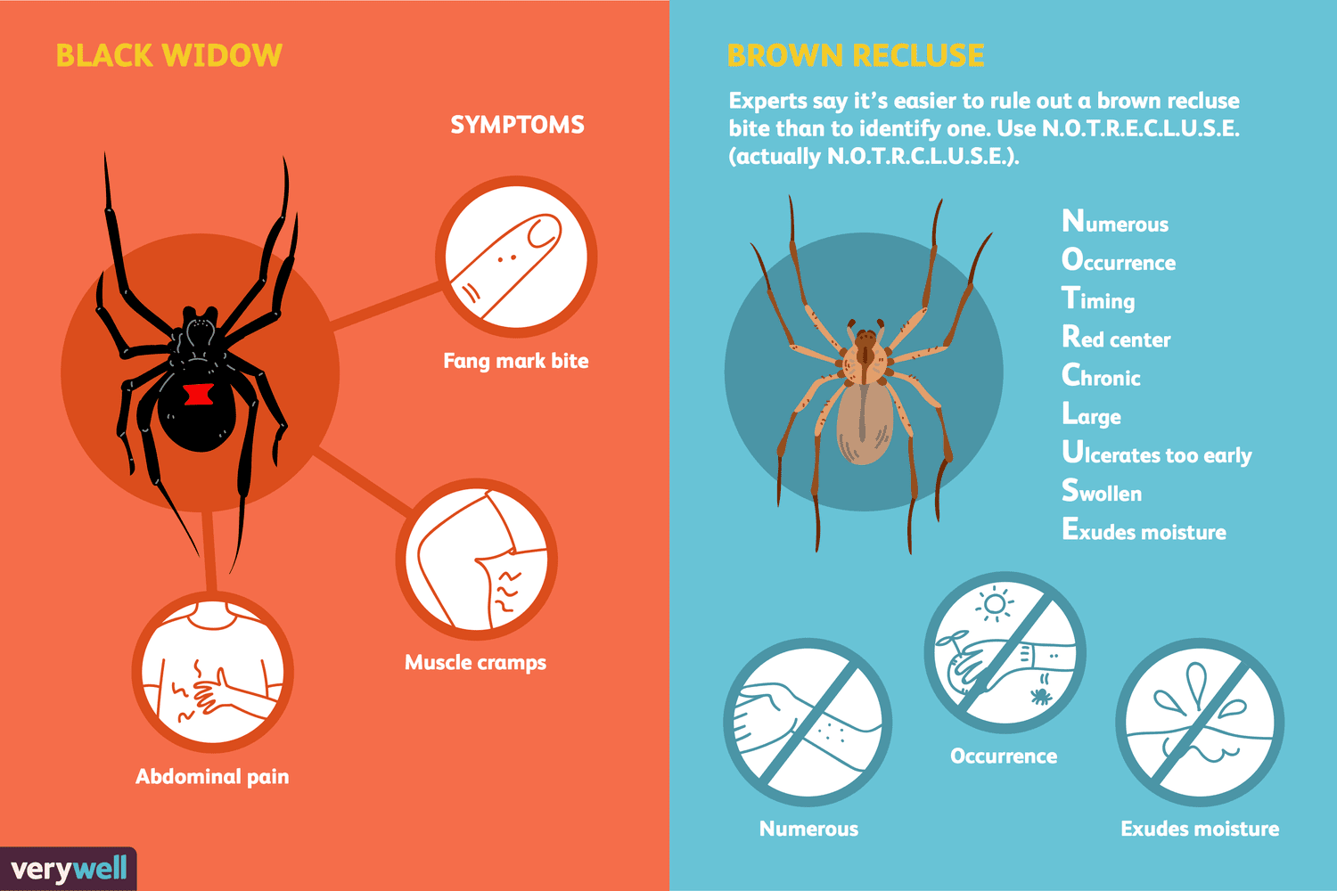 black house spider factsbite symptoms (1)