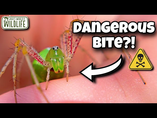 green lynx spider poisonous to humans & bite symptoms (4)