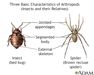 sydney funnel web spider (3)